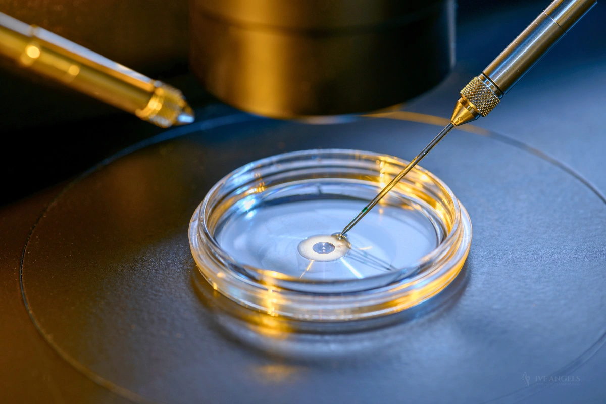 In vitro fertilization (IVF) treatment in Goa at IVF Angels Clinic