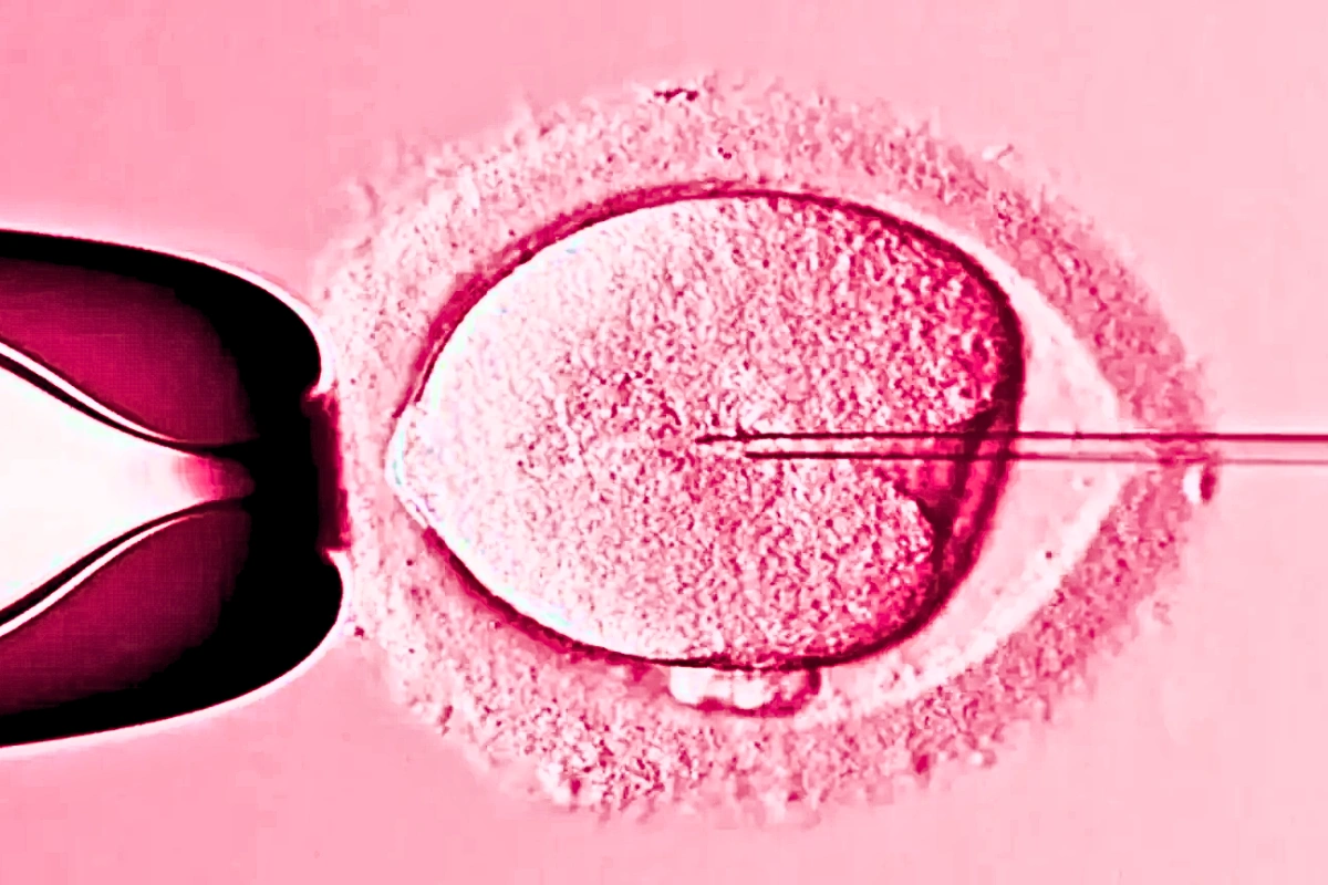 Laser Assisted Hatching procedure for IVF success at IVF Angels Goa