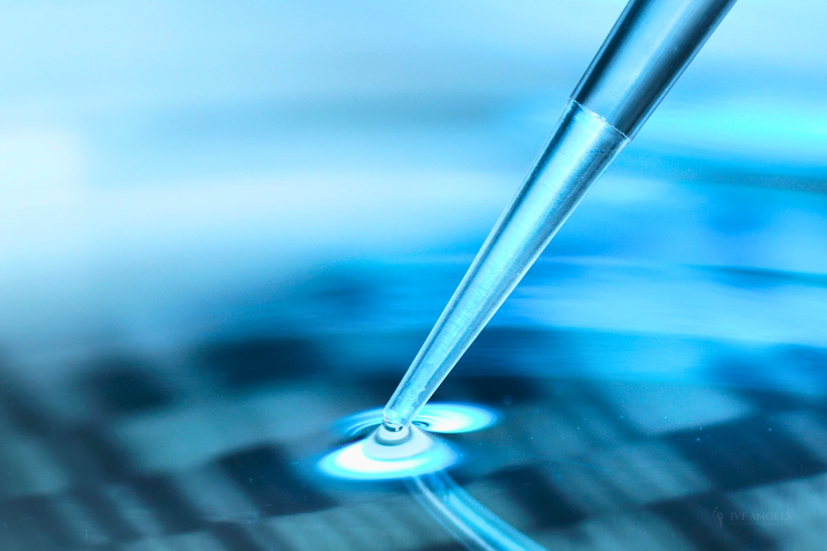 IUI fertility treatment in Goa at IVF Angels